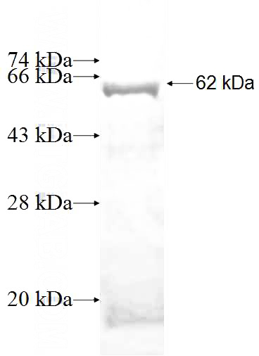 Recombinant Human ITPK1 SDS-PAGE