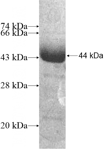 Recombinant Human FANK1 SDS-PAGE