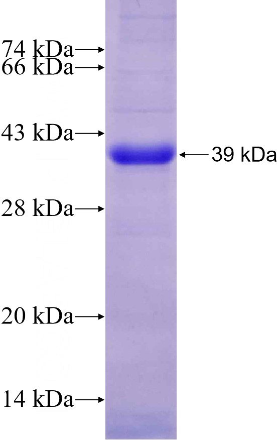 Recombinant Human UGDH SDS-PAGE