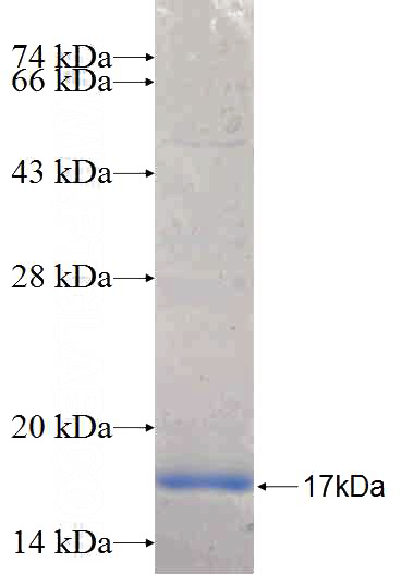 Recombinant Human ITGB1BP3 SDS-PAGE