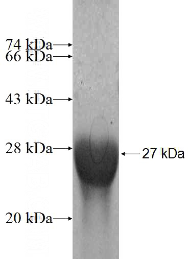 Recombinant Human GNPNAT1 SDS-PAGE