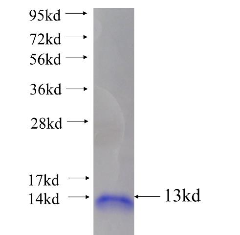 Recombinant human LPAR5 SDS-PAGE
