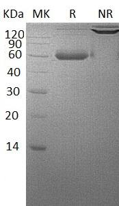 Human BMPR1A/ACVRLK3/ALK3 (Fc & His tag) recombinant protein