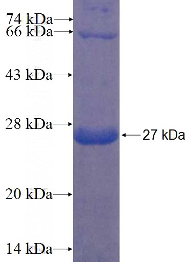 Recombinant Human TMEM74 SDS-PAGE