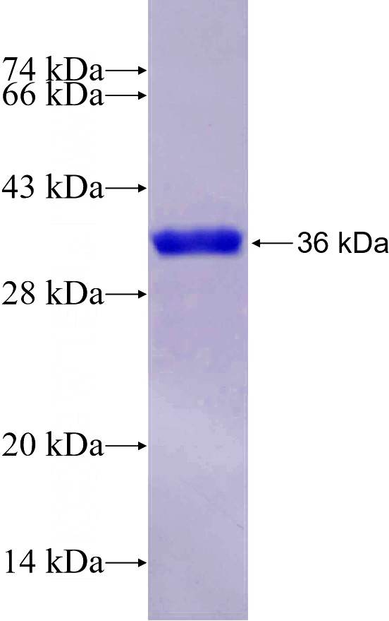 Recombinant Human OCT2 SDS-PAGE