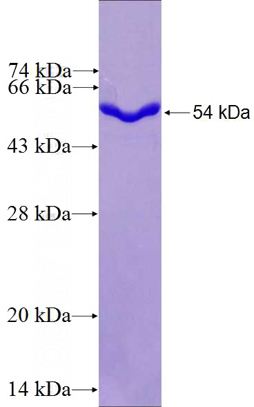 Recombinant Human USP8 SDS-PAGE