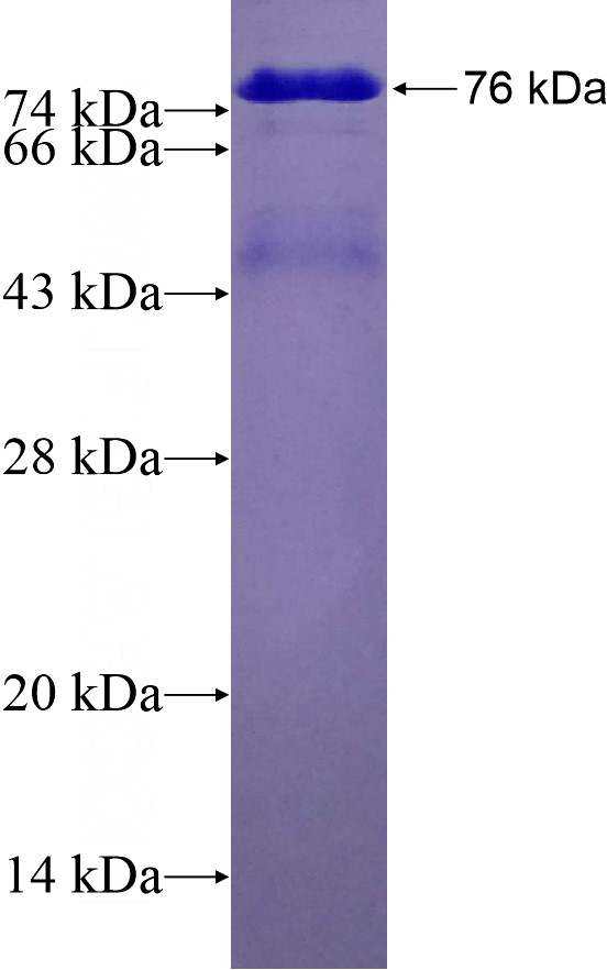 Recombinant Human TAF7 SDS-PAGE