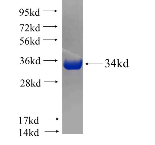 Recombinant human RDH10 SDS-PAGE