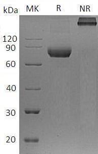 Human IL5RA/IL5R (Fc tag) recombinant protein