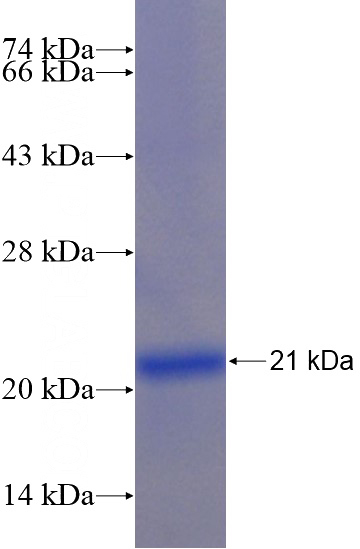 Recombinant Human SLCO4C1 SDS-PAGE