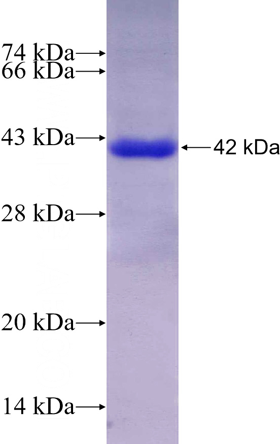 Recombinant Human CKAP4 SDS-PAGE
