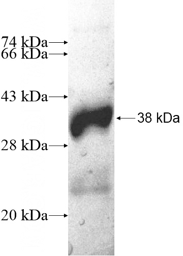 Recombinant Human HMGCLL1 SDS-PAGE