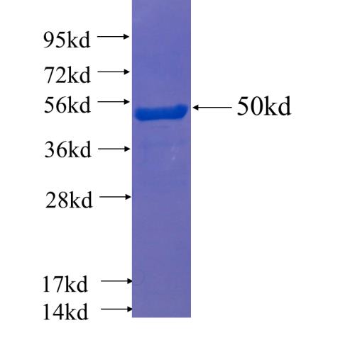 Recombinant human KRT14 SDS-PAGE