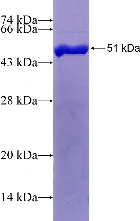 Recombinant Human KIAA1958 SDS-PAGE