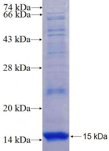 Recombinant Human Supervillin SDS-PAGE