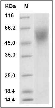 Rat IL17RA / IL17R Protein (His Tag) SDS-PAGE