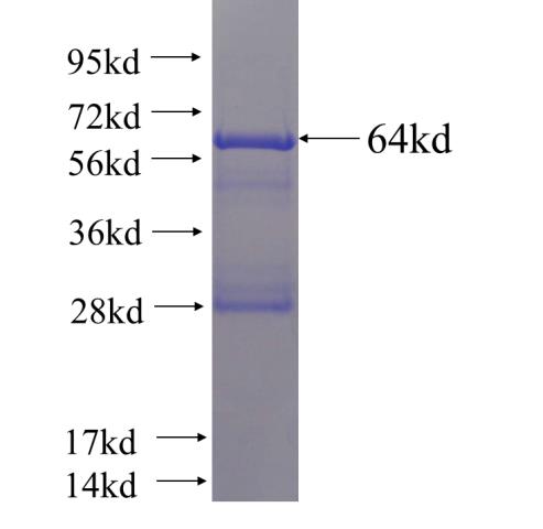 Recombinant human RORC SDS-PAGE