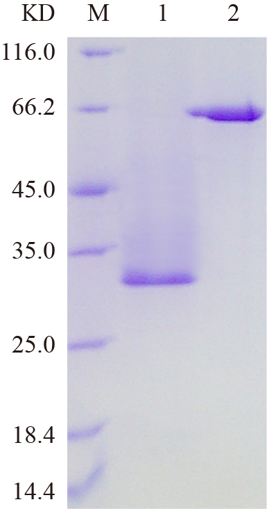 Recombinant ACHB protein (His tag) SDS-PAGE