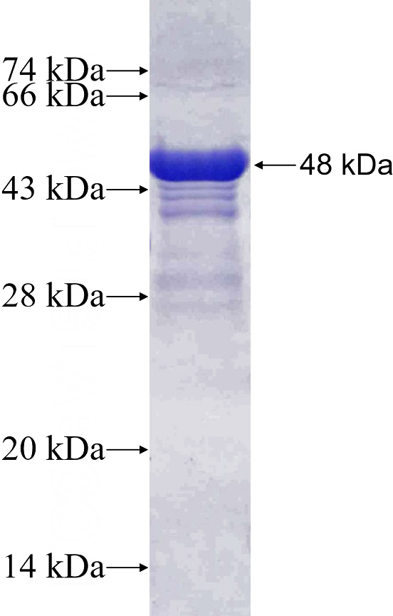 Recombinant Human SLC12A5 SDS-PAGE