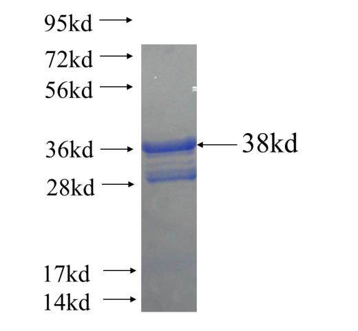 Recombinant human ABLIM2 SDS-PAGE