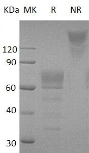 Human PDPN/GP36/PSEC0003/PSEC0025 (Fc tag) recombinant protein