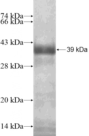 Recombinant Human TBC1D10B SDS-PAGE