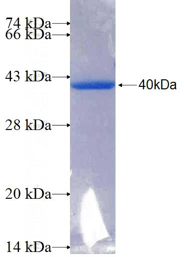 Recombinant Human ADAM32 SDS-PAGE