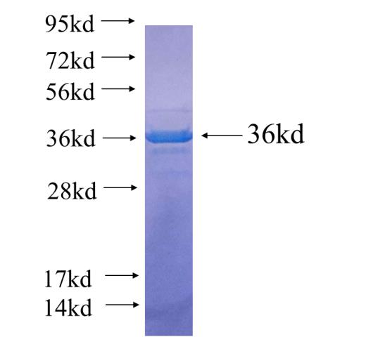 Recombinant human MAPK8IP2 SDS-PAGE