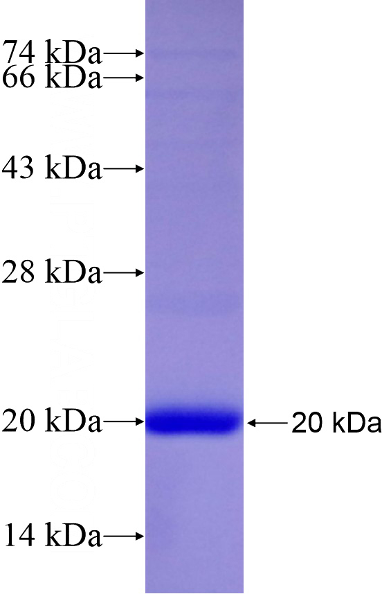 Recombinant Human CCNI SDS-PAGE