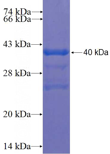 Recombinant Human ARHGEF3 SDS-PAGE