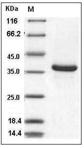 Mouse Epiregulin / EREG Protein (Fc Tag) SDS-PAGE