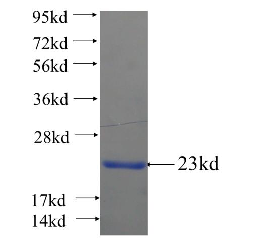Recombinant human TTC32 SDS-PAGE
