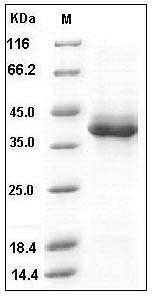 Human S100B Protein (Fc Tag) SDS-PAGE