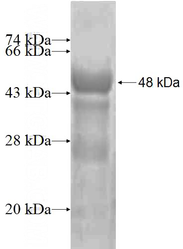 Recombinant Human SSSCA1 SDS-PAGE