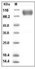 Human FGFR1 / CD331 Protein (His & Fc Tag) SDS-PAGE