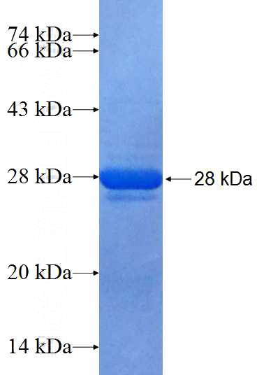Recombinant Human MRPS26 SDS-PAGE