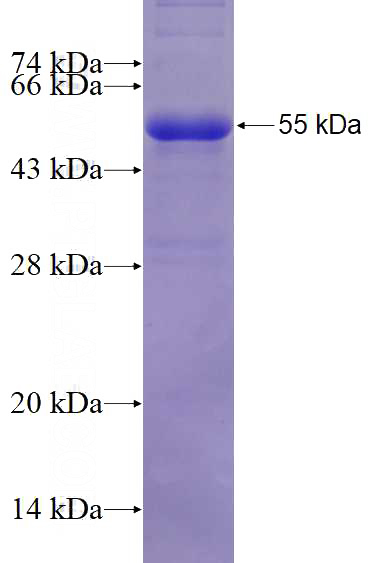 Recombinant Human NID1 SDS-PAGE