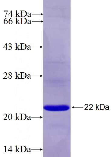 Recombinant Human LRRC8E SDS-PAGE