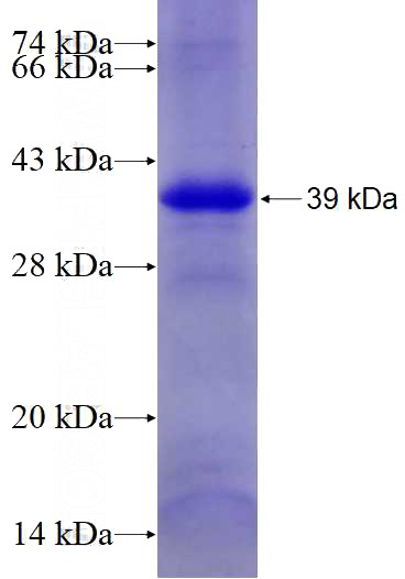 Recombinant Human FASTKD2 SDS-PAGE