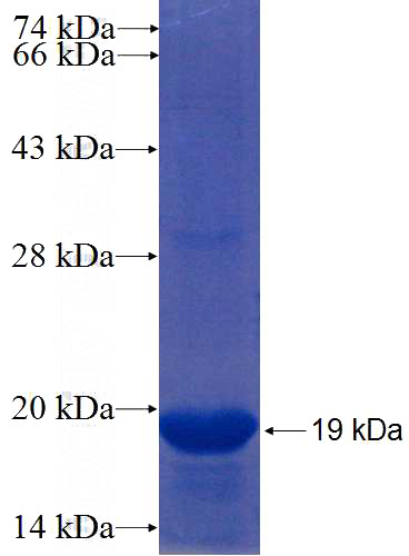 Recombinant Human ZNF193 SDS-PAGE