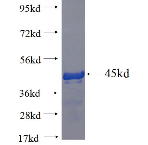 Recombinant human WFDC1 SDS-PAGE