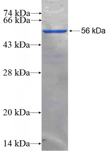 Recombinant Human SNAI2 SDS-PAGE