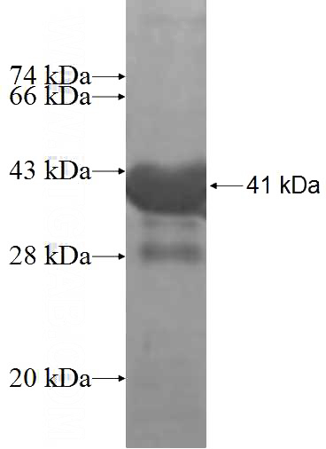 Recombinant Human SEC13 SDS-PAGE