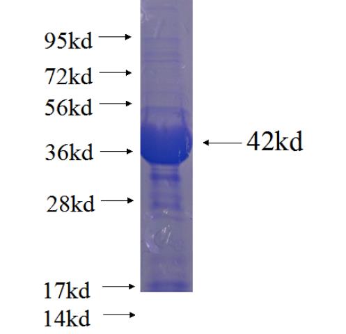 Recombinant human MALT1 SDS-PAGE