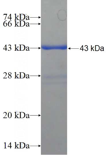 Recombinant Human ZNF645 SDS-PAGE