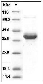 Human S100A4 Protein (Fc Tag) SDS-PAGE