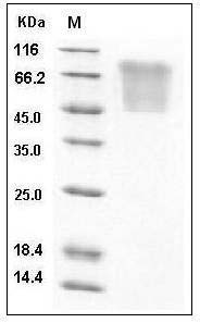 Human CCL5 / RANTES Protein (His & mucin Tag) SDS-PAGE