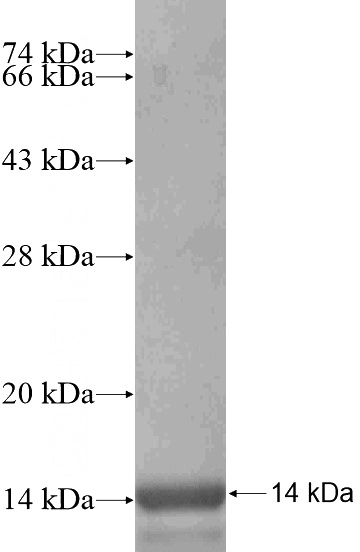 Recombinant Human CMKLR1 SDS-PAGE