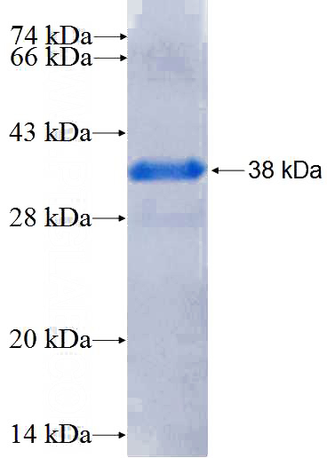 Recombinant Human CYP21A2 SDS-PAGE