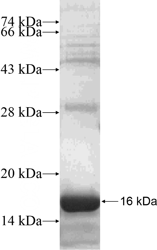 Recombinant Human UPK1A SDS-PAGE